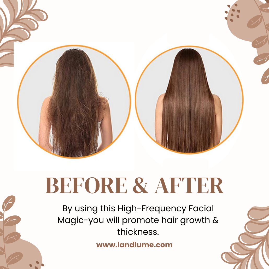 Darsonval 4-Wand High-Frequency Facial Magic